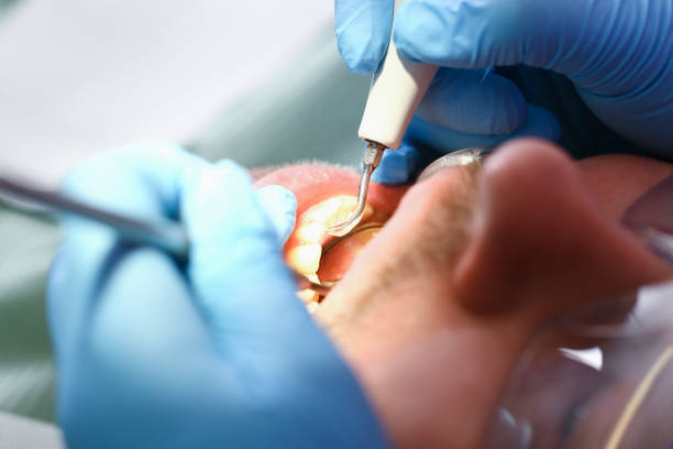 Best Emergency Treatment for Toothache in New Johnsonville, TN