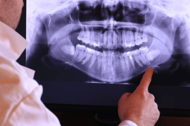 Best Emergency Broken Tooth Repair in New Johnsonville, TN